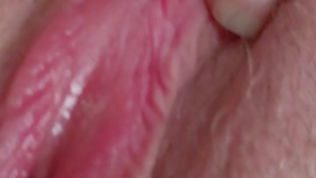 Trans Girl Shows Pussy After 2 Weeks On Testosterone